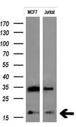 MSMB Antibody in Western Blot (WB)