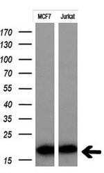 MSMB Antibody in Western Blot (WB)