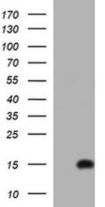 MSMB Antibody in Western Blot (WB)