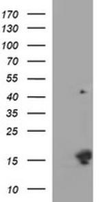 MSMB Antibody in Western Blot (WB)