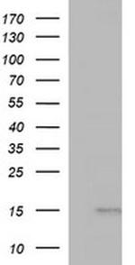 MSMB Antibody in Western Blot (WB)