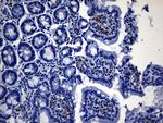 MSR1 Antibody in Immunohistochemistry (Paraffin) (IHC (P))