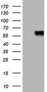 MSR1 Antibody in Western Blot (WB)