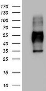 MSR1 Antibody in Western Blot (WB)