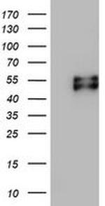 MSR1 Antibody in Western Blot (WB)