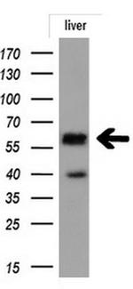 MSR1 Antibody in Western Blot (WB)