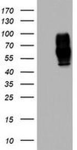 MSR1 Antibody in Western Blot (WB)