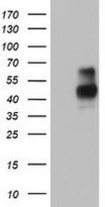 MSR1 Antibody in Western Blot (WB)