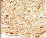 MST1 Antibody in Immunohistochemistry (IHC)