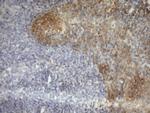 MST1 Antibody in Immunohistochemistry (Paraffin) (IHC (P))