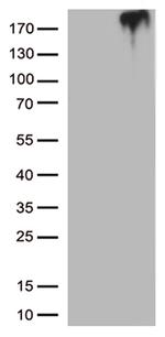 MST1R Antibody in Western Blot (WB)