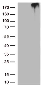 MST1R Antibody in Western Blot (WB)