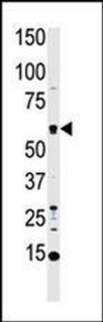 MST1 Antibody in Western Blot (WB)