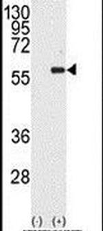 MST1 Antibody in Western Blot (WB)