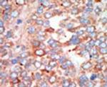 MST3 Antibody in Immunohistochemistry (IHC)
