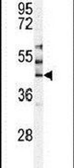MST3 Antibody in Western Blot (WB)