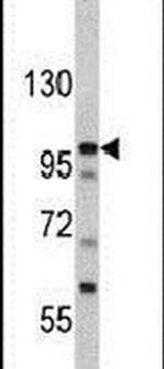 MTBP Antibody in Western Blot (WB)