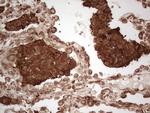 MTDH Antibody in Immunohistochemistry (Paraffin) (IHC (P))
