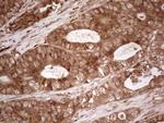 MTDH Antibody in Immunohistochemistry (Paraffin) (IHC (P))