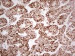 MTDH Antibody in Immunohistochemistry (Paraffin) (IHC (P))