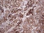 MTDH Antibody in Immunohistochemistry (Paraffin) (IHC (P))