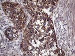 MTDH Antibody in Immunohistochemistry (Paraffin) (IHC (P))