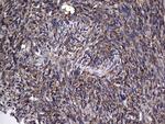MTDH Antibody in Immunohistochemistry (Paraffin) (IHC (P))