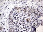 MTDH Antibody in Immunohistochemistry (Paraffin) (IHC (P))
