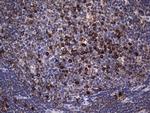 MTDH Antibody in Immunohistochemistry (Paraffin) (IHC (P))