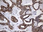 MTDH Antibody in Immunohistochemistry (Paraffin) (IHC (P))