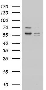 MTDH Antibody in Western Blot (WB)