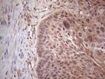 MTF1 Antibody in Immunohistochemistry (Paraffin) (IHC (P))