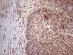 MTF1 Antibody in Immunohistochemistry (Paraffin) (IHC (P))