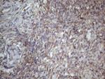 MTF1 Antibody in Immunohistochemistry (Paraffin) (IHC (P))