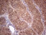 MTF1 Antibody in Immunohistochemistry (Paraffin) (IHC (P))
