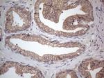 MTF1 Antibody in Immunohistochemistry (Paraffin) (IHC (P))