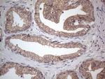 MTF1 Antibody in Immunohistochemistry (Paraffin) (IHC (P))