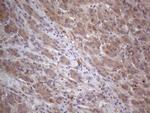 MTF1 Antibody in Immunohistochemistry (Paraffin) (IHC (P))