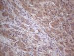 MTF1 Antibody in Immunohistochemistry (Paraffin) (IHC (P))