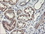 MTFMT Antibody in Immunohistochemistry (Paraffin) (IHC (P))