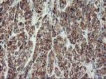 MTFMT Antibody in Immunohistochemistry (Paraffin) (IHC (P))