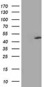 MTFMT Antibody in Western Blot (WB)