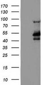 MTFMT Antibody in Western Blot (WB)