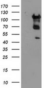MTFMT Antibody in Western Blot (WB)