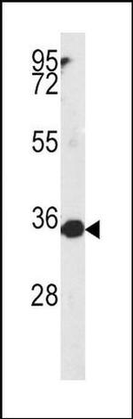 MTHFD2 Antibody in Western Blot (WB)