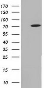 MTMR14 Antibody in Western Blot (WB)