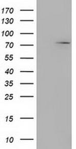 MTMR14 Antibody in Western Blot (WB)