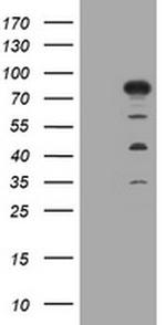 MTMR2 Antibody in Western Blot (WB)