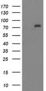 MTMR2 Antibody in Western Blot (WB)