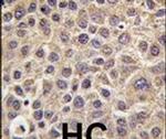 MTMR8 Antibody in Immunohistochemistry (IHC)